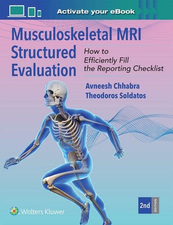 9781975234065 Musculoskeletal MRI Structured Evaluation, Verzenden, Nieuw, Avneesh Chhabra