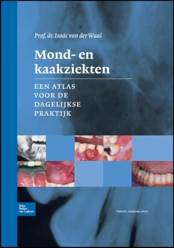 Mond- en kaakziekten - Isaac van der Waal 9789031386093, Verzenden, Gelezen, Isaac van der Waal