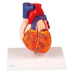 Anatomie model hart met bypasses, 2-delig, 14x8x8 cm, Nieuw