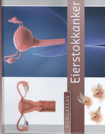 Zorgatlas Eierstokkanker | Nieuw, Ophalen of Verzenden, Nieuw, Arnold Krüse; Wim Van der Steeg; Bernadette Rigterink; Roelien Schaapman