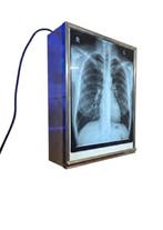 Medisch instrument - Negatoscoop - Staal, Aluminium,