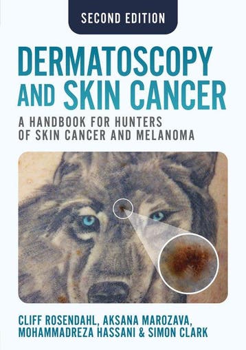 9781914961670 Dermatoscopy and Skin Cancer, second edition, Verzenden, Nieuw, Cliff Rosendahl