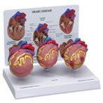 Anatomie model hart, 3 stuks mini, Nieuw