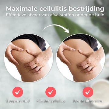 2dekans | Nuvance - Elektrisch Cellulite Massage Apparaat -, Ophalen of Verzenden, Zo goed als nieuw