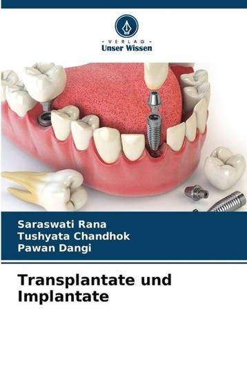 9786206575061 Transplantate und Implantate, Verzenden, Nieuw, Saraswati Rana