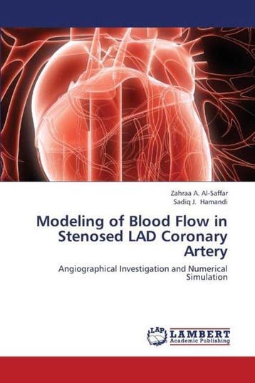 9783659426483 Modeling of Blood Flow in Stenosed Lad Coro..., Verzenden, Nieuw, Al-Saffar Zahraa a