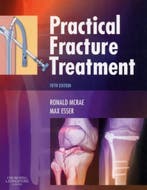 Practical Fracture Treatment 9780443068768 Ronald McRae, Verzenden, Gelezen, Ronald McRae