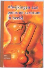 Afwijkingen aan penis en scrotum in beeld 9789031352920, Verzenden, Gelezen, Leliefeld