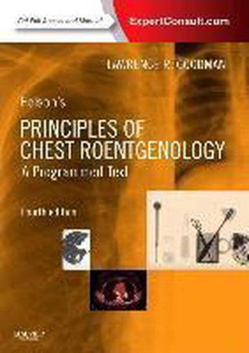 Felsons Principles of Chest Roentgenology, A Programmed, Verzenden, Gelezen, Lawrence R. Goodman