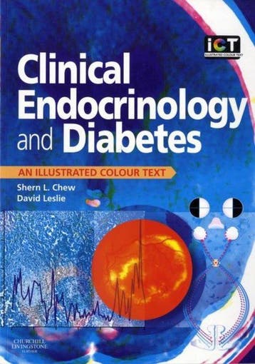 Clinical Endocrinology and Diabetes - Shern Chew, Verzenden, Gelezen, Shern Chew