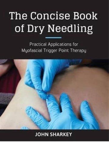 9781905367672 Concise Book Of Dry Needling, Verzenden, Nieuw, John Sharkey