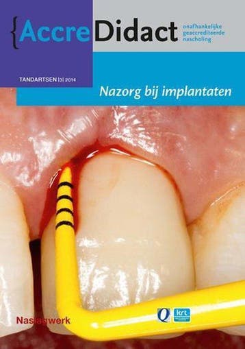 9789089761620 AccreDidact TA2014-3 - Nazorg bij implantaten, Verzenden, Zo goed als nieuw, Gordon van der Avoort