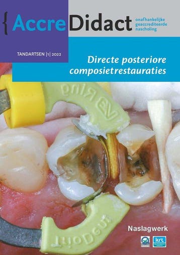 9789089764300 AccreDidact TA2022-1 - Directe posteriore c..., Verzenden, Zo goed als nieuw, Bas Loomans