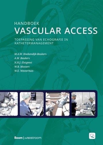 9789024465132 Handboek vascular access M.A.W. Hoekendijk-..., Boeken, Verzenden, Nieuw, M.A.W. Hoekendijk- Beukers
