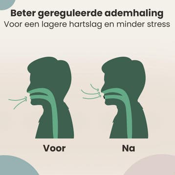 Rustige Nacht® Mondtape PRO - Anti Snurk Mond Tape - 30, Ophalen of Verzenden, Nieuw
