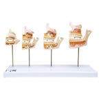 Anatomie model kaak- en gebitsontwikkeling, 33x10x20 cm, Nieuw
