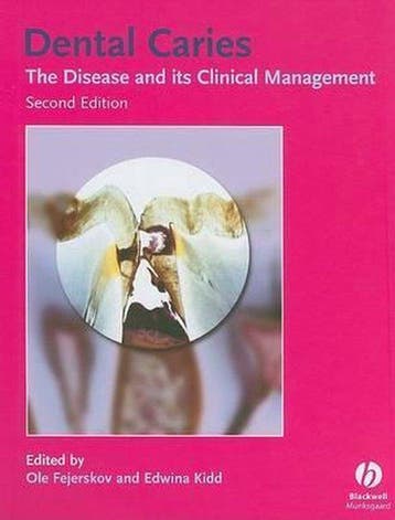 Boek Dental Caries 9781405138895, Boeken, Verzenden, Zo goed als nieuw