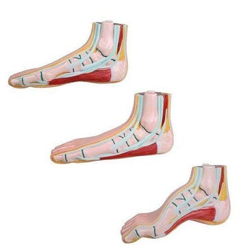 Anatomie model voet (normale voet, platvoet en holvoet), Nieuw