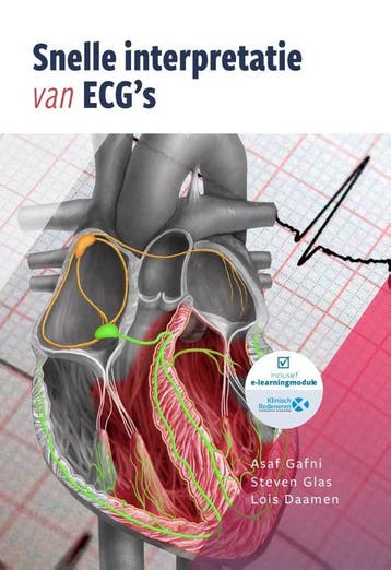 Snelle interpretatie van ECGs 9789083139319, Boeken, Verzenden, Zo goed als nieuw