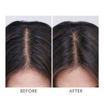 Moroccanoil Oily Scalp Treatment (Haarolie), Verzenden, Nieuw