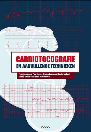 Cardiotocografie en aanvullende technieken - Yves Jacquemyn, Boeken, Verzenden, Gelezen, Yves Jacquemyn