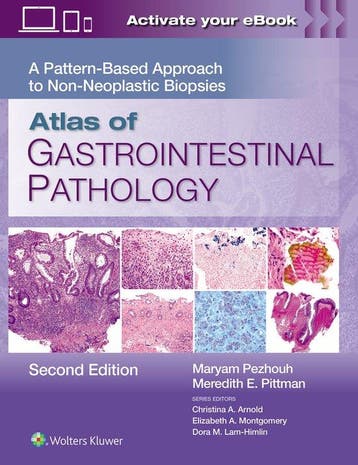 9781975218294 Atlas of Gastrointestinal Pathology, Verzenden, Nieuw, Maryam Kherad Pezhouh