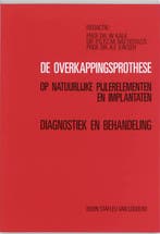 De overkappingsprothese op natuurlijke pijlere 9789031311521, Boeken, Verzenden, Zo goed als nieuw
