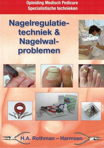 Nagelregulatietechniek en nagelwalproblemen -, Verzenden, Gelezen, Rothman-Harmsen