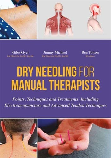 9781848192553 Dry Needling For Manual Therapists, Verzenden, Nieuw, Giles Gyer