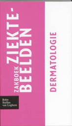 Zakboek Ziektebeelden - Zakboek ziektebeelden Dermatologie 9, Verzenden, Zo goed als nieuw