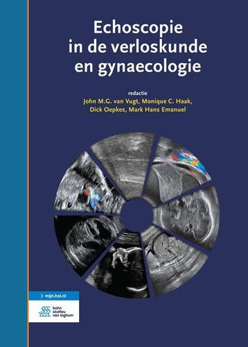 Echoscopie in de verloskunde en gynaecologie 9789036814508, Boeken, Zo goed als nieuw