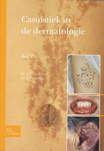 Casuïstiek in de dermatologie - A.C. Groot 9789031384570, Verzenden, Gelezen, A.C. Groot