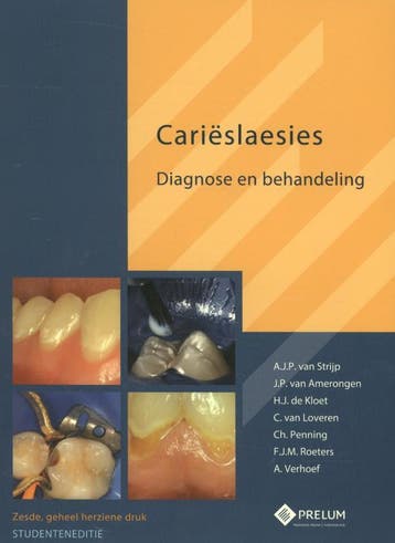 Carieslaesies-studenteneditie - J.P. van Amerongen, Verzenden, Gelezen, J.P. van Amerongen