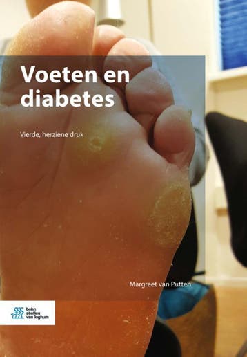 Voeten en diabetes - Margreet van Putten 9789036802789, Boeken, Verzenden, Zo goed als nieuw, Margreet van Putten