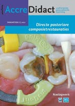 Directe posteriore composietrestauraties / AccreDidact /, Boeken, Verzenden, Zo goed als nieuw, Bas Loomans