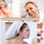 Wenkbrauw Trimmer Gezichtsontharing Apparaat Dames -, Ophalen of Verzenden, Zo goed als nieuw