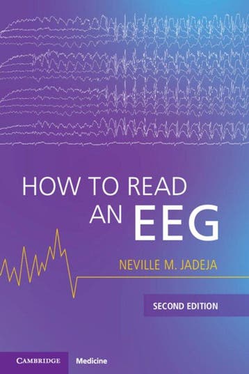9781009539227 How to Read an EEG Neville M. Jadeja, Verzenden, Nieuw, Neville M. Jadeja
