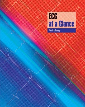 ECG at a Glance - Patrick Davey 9780632054053, Boeken, Verzenden, Gelezen, Patrick Davey
