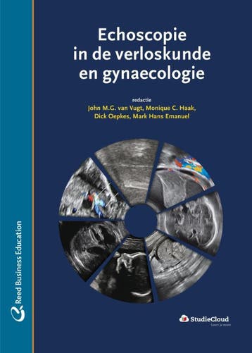Echoscopie in de verloskunde en gynaecologie 9789035233973, Verzenden, Zo goed als nieuw