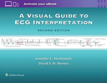 A Visual Guide to ECG Interpretation, Boeken, Verzenden, Nieuw