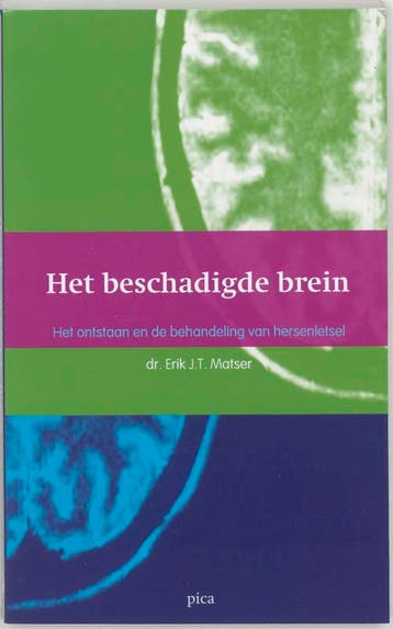 Het beschadigde brein - E.J.T. Matser 9789077671016, Verzenden, Zo goed als nieuw, E.J.T. Matser