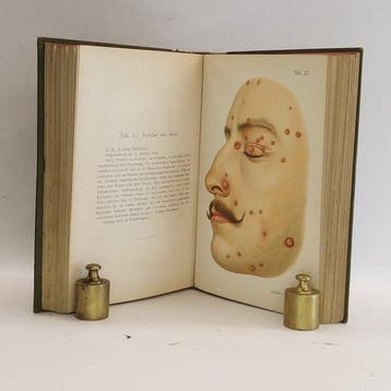 Franz Mraek - Atlas der syphilis - 1898