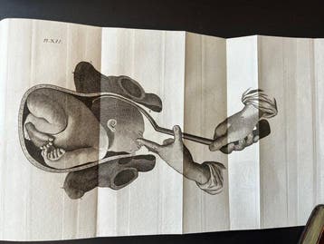 J. L. Baudelocque - L’Art des accouchemens - 1815, Antiek en Kunst