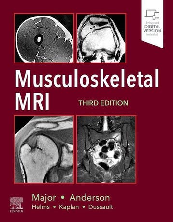9780323415606 Musculoskeletal MRI Nancy Major, Verzenden, Nieuw, Nancy Major