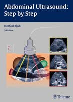 9783131383631 Abdominal Ultrasound: Step by Step, Boeken, Verzenden, Zo goed als nieuw, Berthold Block