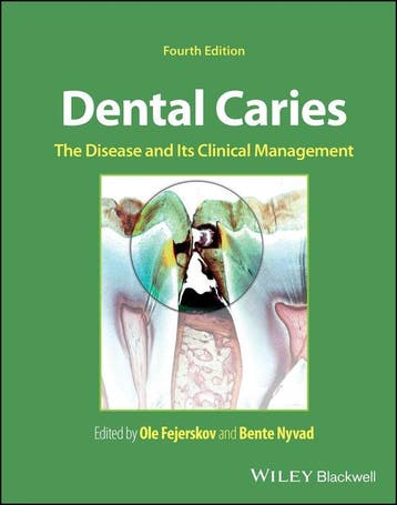 9781119679370 Dental Caries, Boeken, Verzenden, Nieuw