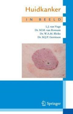 Huidkanker in beeld - M.M. van Rossum 9789031381821, Boeken, Verzenden, Zo goed als nieuw, M.M. van Rossum