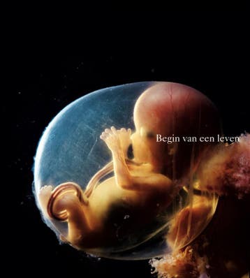 Begin van een leven - Lennart Nilsson 9789021667690, Boeken, Verzenden, Zo goed als nieuw, Lennart Nilsson