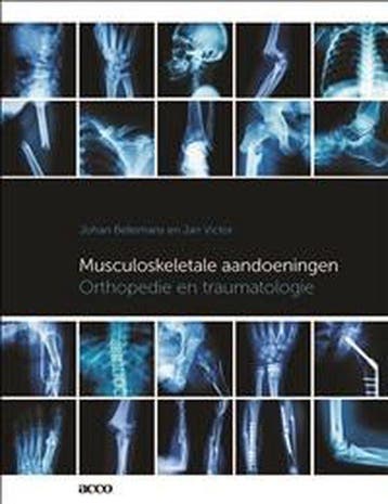 Boek Musculoskeletale aandoeningen 9789463443890, Verzenden, Zo goed als nieuw