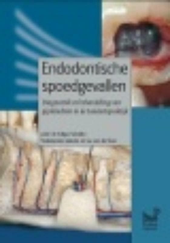 Endodontische spoedgevallen - Edgar Schäfer 9789085620631, Boeken, Wetenschap, Zo goed als nieuw, Verzenden